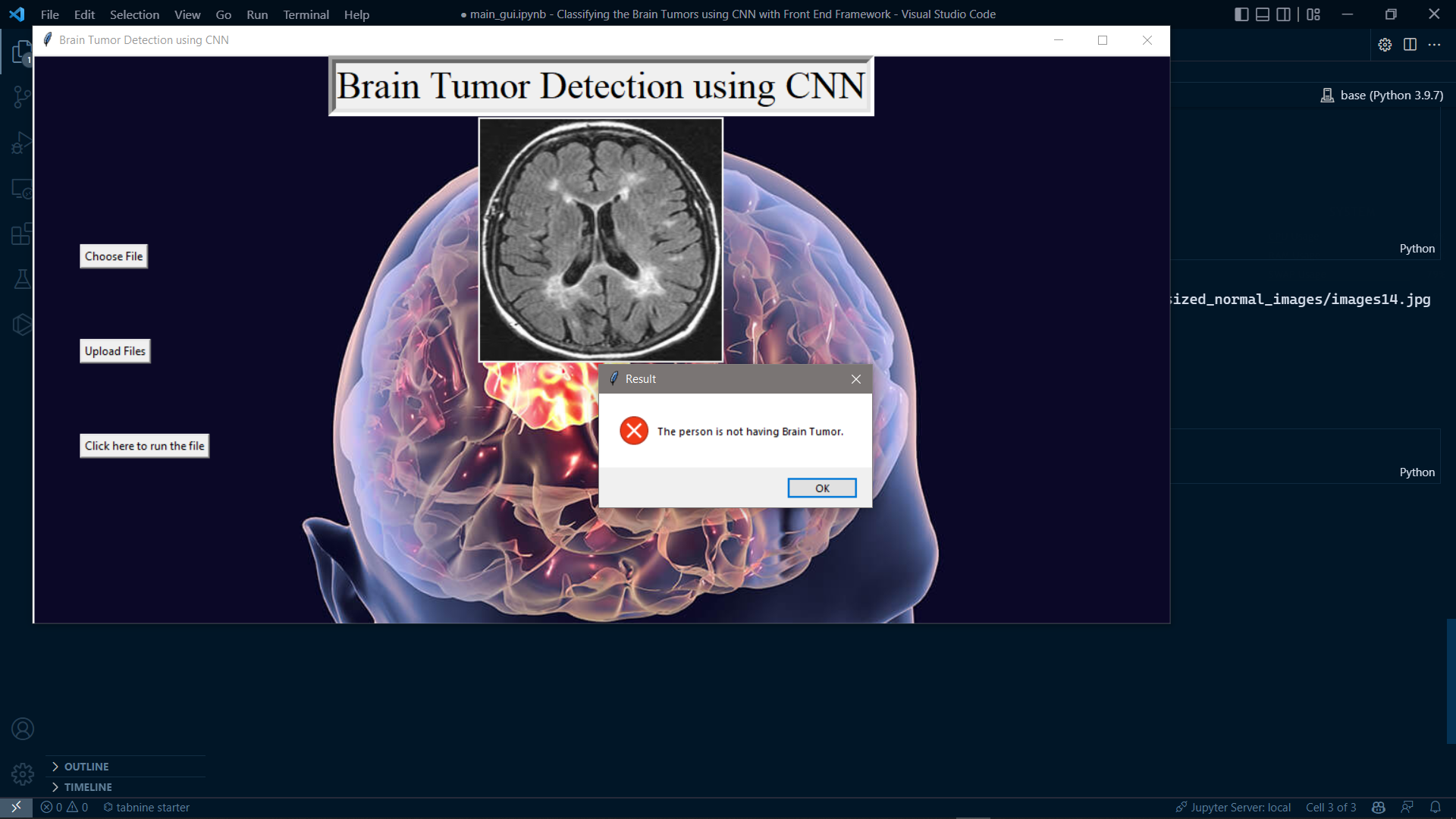 Classifying Brain Tumor