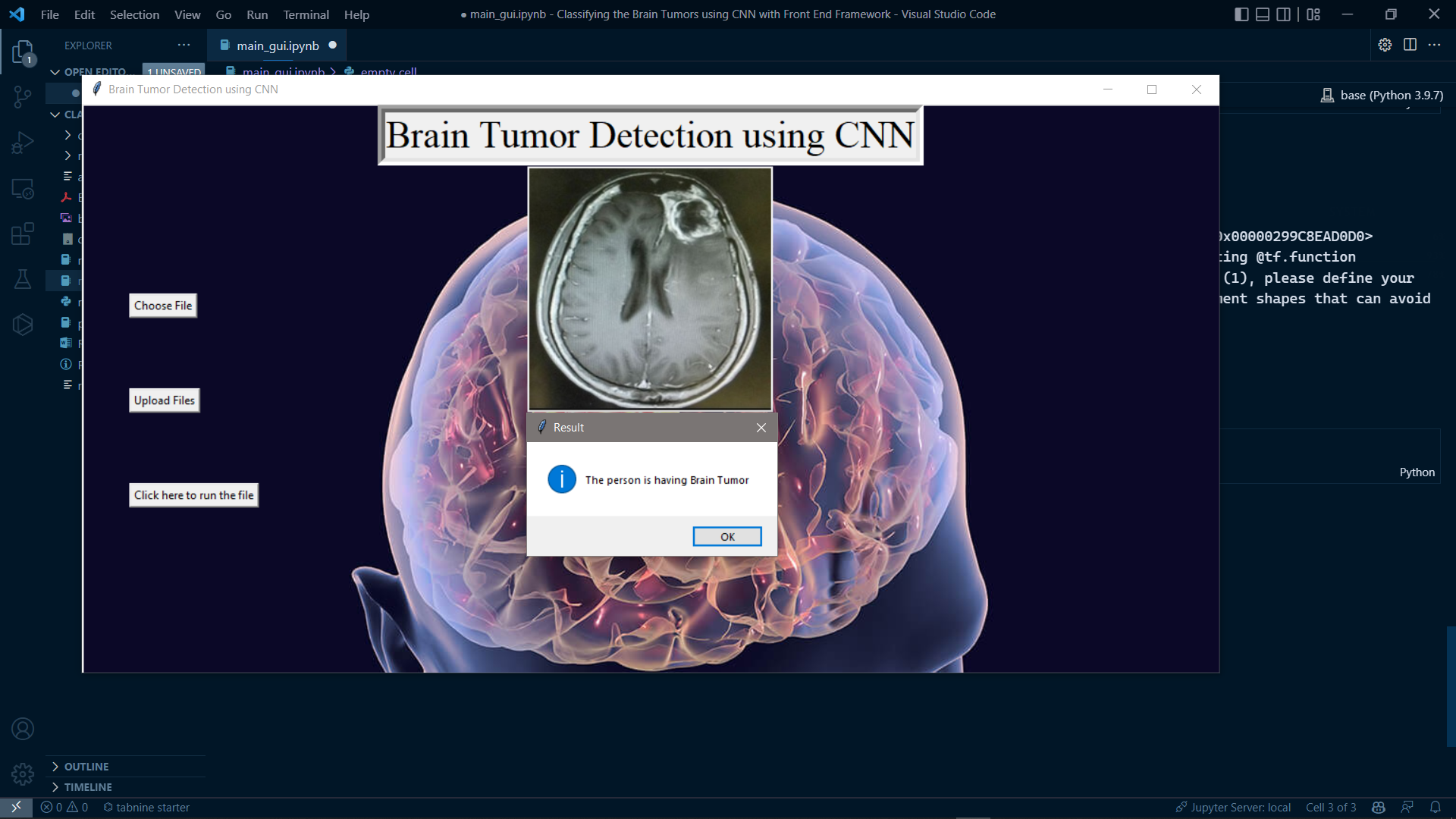 Classifying Brain Tumor Using CNN