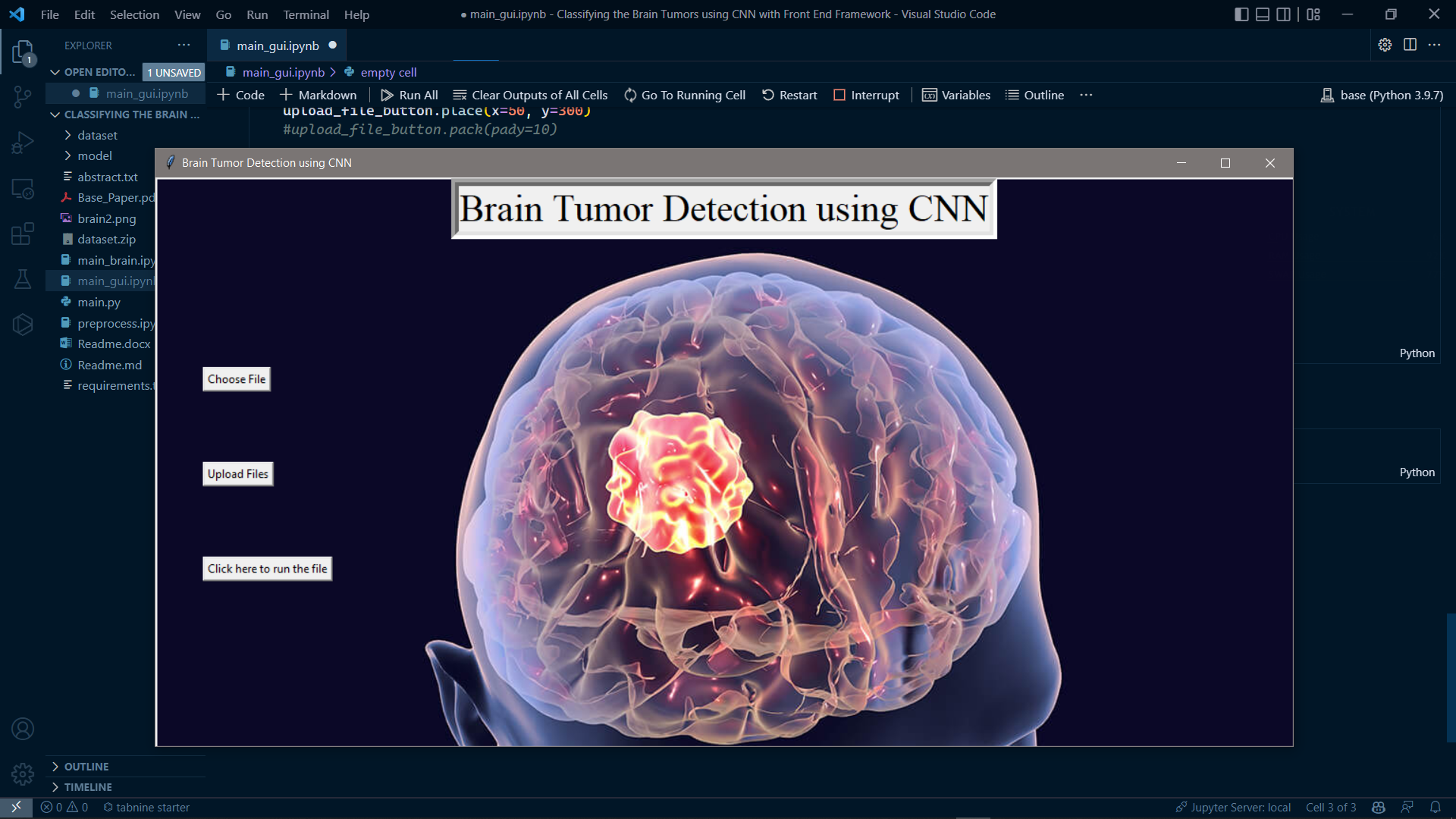 Classifying Brain Tumor Using CNN final result