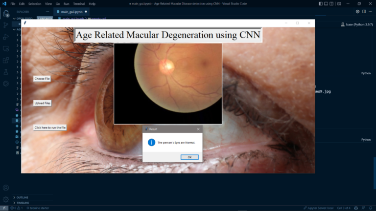 Age Related Macular Disease