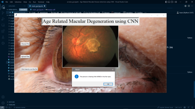 Age Related Macular Disease
