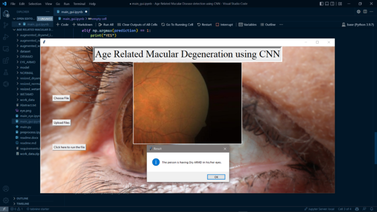Age Related Macular Disease Detection Using CNN