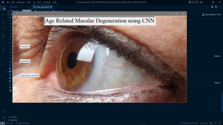 Age Related Macular Disease Detection final result