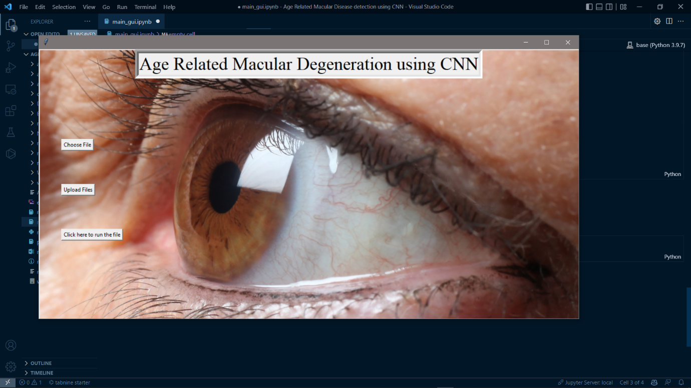 Age Related Macular Disease Detection final result