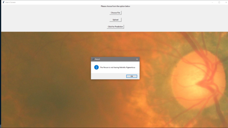 detection of retina final result