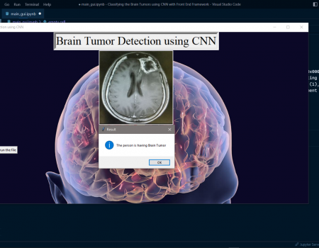 Classifying Brain Tumor Using CNN